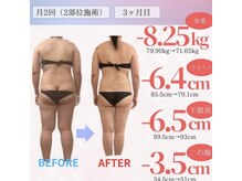 アフリオーラ はなみずき店(affriolant)/ビフォーアフター