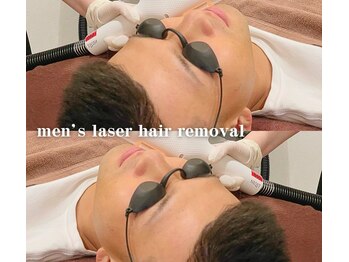 ビューティーバーコア(Beauty bar KOA)/メンズ・顔全体光脱毛