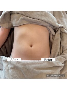 アンベリール(Embellir)/ぽっこりお腹撃退!