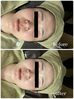 ジャスミン(Jasmin)/オーダーメイド高濃度原液導入