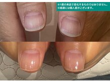 地爪ケアクリニックサロン 代々木店/ナチュラルで美しい爪に