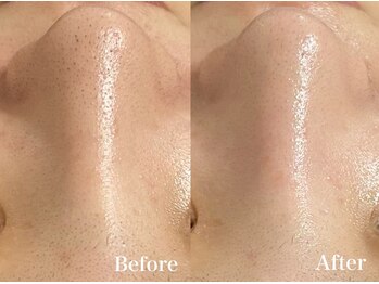 マシェ バイ マユ(Mache by Mayu)/つるん♪近付かれても怖くない！