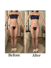 ハリムーン 仙台(harimoon)/ブライダル