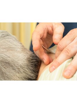 鍼灸施術を受けたい