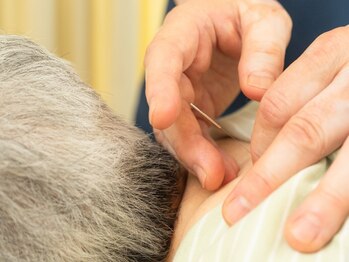 アガペー鍼灸の写真/【腰痛改善の鍼灸施術】不調の状態を見極め根本改善へ導く!背中のつらい部分も的確に施術いたします◎