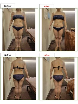 エステティック レイビス 銀座店(RAYVIS)/before＆after