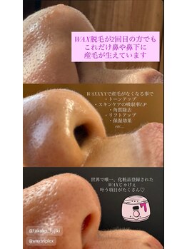 パタティパタタ(PatatiPatata)/お鼻は毛穴が密集しています