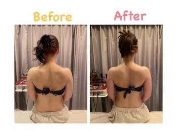 クレビア 麻布十番(CREBIA)/【痩身/代謝促進】