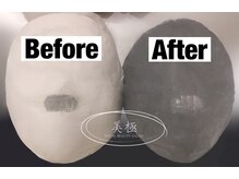 美極 銀座店/銀座/小顔コルギ/小顔矯正