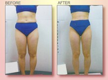 ジュリア オージェ 京橋店/ ビフォーアフター（脂肪燃焼）