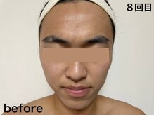 ダルセーニョ/【ボクを見て！】