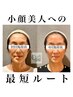 《ご新規の方》小顔頭蓋骨矯正＋リンパケア4回コース　￥30800→￥22800