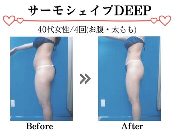 スパイア(SPIRE)/サーモシェイプDEEP★下半身