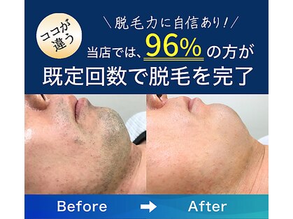 アリッサムフォーメン 岡山店(ALiSSUM for men)の写真