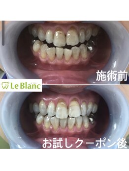 ルブラン 奈良店(Le Blanc)/歯のお悩みありませんか？