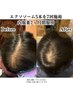 【頭髪/頭皮ケア】無料ご相談・カウンセリング
