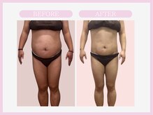 アコガレコガオ 秋田店/