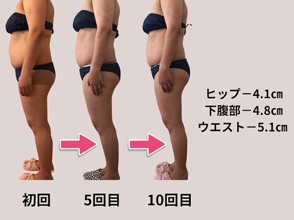 パルタージュ(Partage)の写真