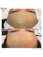 プリュスマイル(+Smile.)/おでこワックス