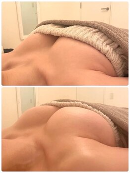 美人バスト 札幌店/バストアップ×育乳◇症例◇