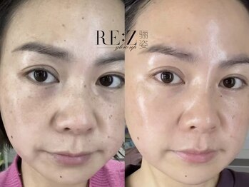 ブリエ(Brille)/韓国最先端美容◎水光肌ピール