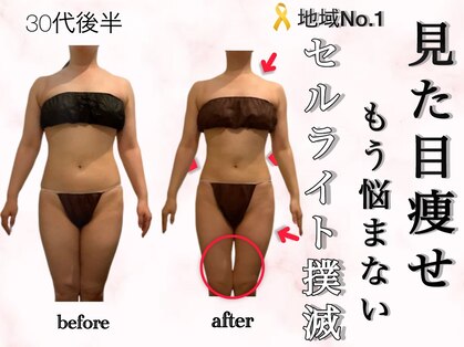 キュール(KuhL)の写真