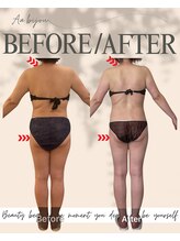 エイエービジュー(Aa.bijou)/