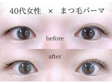 セイン 根津 千駄木(Sein)/左右差を整える