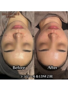 サロン ド エス アオヤマ(SALON DE S AOYAMA)/ララピール+LDM