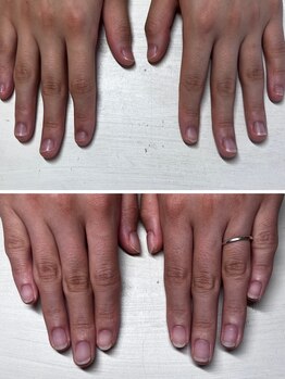 ヴェールリム(verl lim)の写真/【爪の悩み特化☆】深爪・不揃いも美爪へ!再発防止のハンドケアで自信の持てる指先をプロが徹底サポート◇