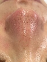 モンド 駒込店(monde)/ハイドラafter