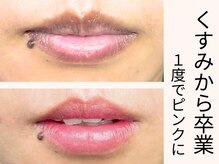 ビュキュアの雰囲気（顔がくすんで見えるのは【唇】が原因かも！？1度でピンクの唇）