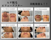 ボゴス 天白店(BOGOSS)