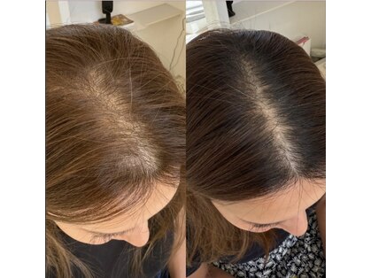 カナエル ビューティーサロン(Canael Beauty salon)の写真