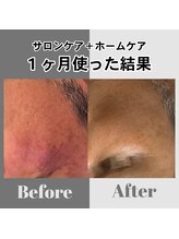 イルガドット 897(ilga.897)