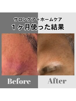 イルガドット 897(ilga.897)の写真/【筑後地区初導入！TOROIAREUKE専門店◇】お肌の悩みで多いシミ・シワを根本的改善・予防に導きます。