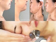サロン ガトレオ(GatoLeo)の雰囲気（顔のむくみ、輪郭、くすみ、老化や毛穴、大人ニキビのケア）