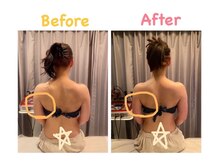 クレビア 麻布十番(CREBIA)/【痩身/代謝促進】