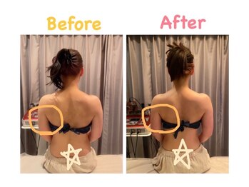 クレビア 麻布十番(CREBIA)/【痩身/代謝促進】