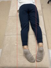 パーソナルケア ボーテ(PERSONAL CARE BEAUTE)/ビフォア　2