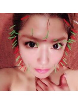 ルディア 堀江店(ledia)/タレント 安西ひろこ様(美容鍼)