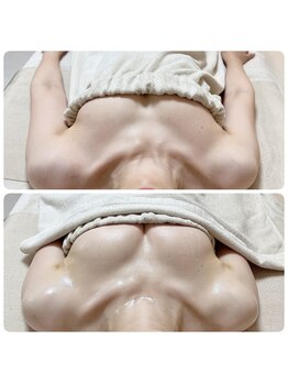 美人バスト リグラス(ReGrous)/バストアップbefore after