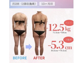 アフリオーラ はなみずき店(affriolant)/ビフォーアフター