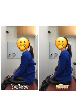 コア カイロプラクティック 錦糸町/姿勢改善