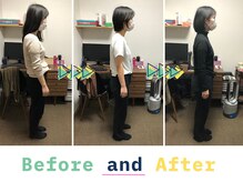 京都中丸整体カイロプラクティックの雰囲気（美容整体コース7回施術　Before・After）