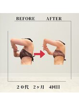 フェムビー 千葉駅前店(FEMBE)/痩身）20代の方の変化