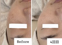 クロア ナゴヤ(Croire NAGOYA)