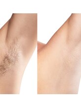 fallon beauty　痩身/フェイシャル/フェム・オムケア/アロマ/ボディケア/脱毛1箇所～