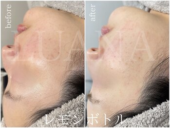 ルアナ(LUANA)/レモンボトル