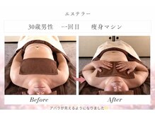 エステラー(ESTELLER)